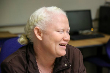Albinism awareness day