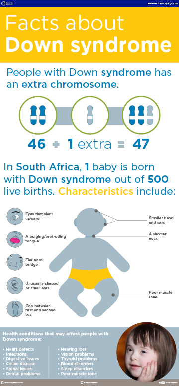Down syndrome infographic