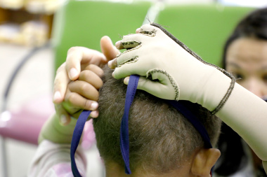 A young patient learning to tie his mask allows him to practice his fine motor skills