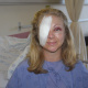 Patient Ingrid Barge after the corneal neurotisation procedure.