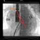 Tygerberg Hospital Congenital Heart Defects awareness week - X-ray images of young girls heart